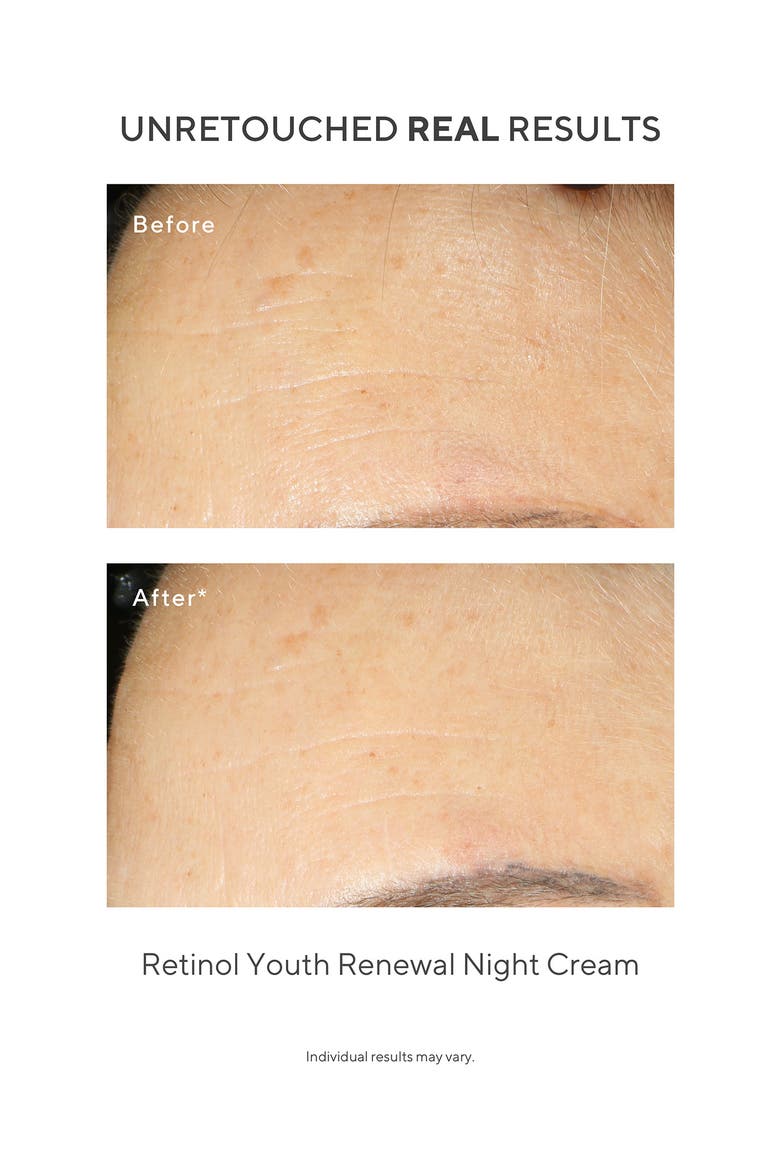 Under the Microscope: The Retinol Renewers Set (Limited Edition) $164 Value, Alternate, color, NO COLOR