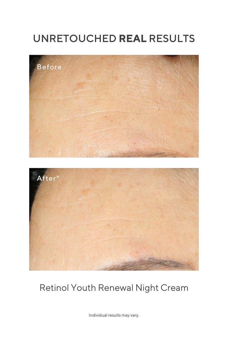 Murad<sup>®</sup> Under the Microscope: The Retinol Renewers Set (Limited Edition) $164 Value, Alternate, color,