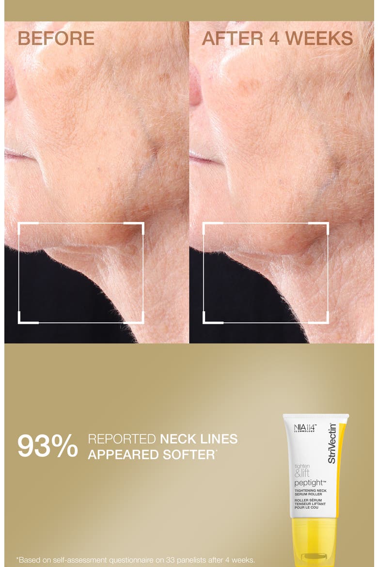 Tighten & Smooth Skin Care Set (Limited Edition) $146 Value, Alternate, color, NO COLOR
