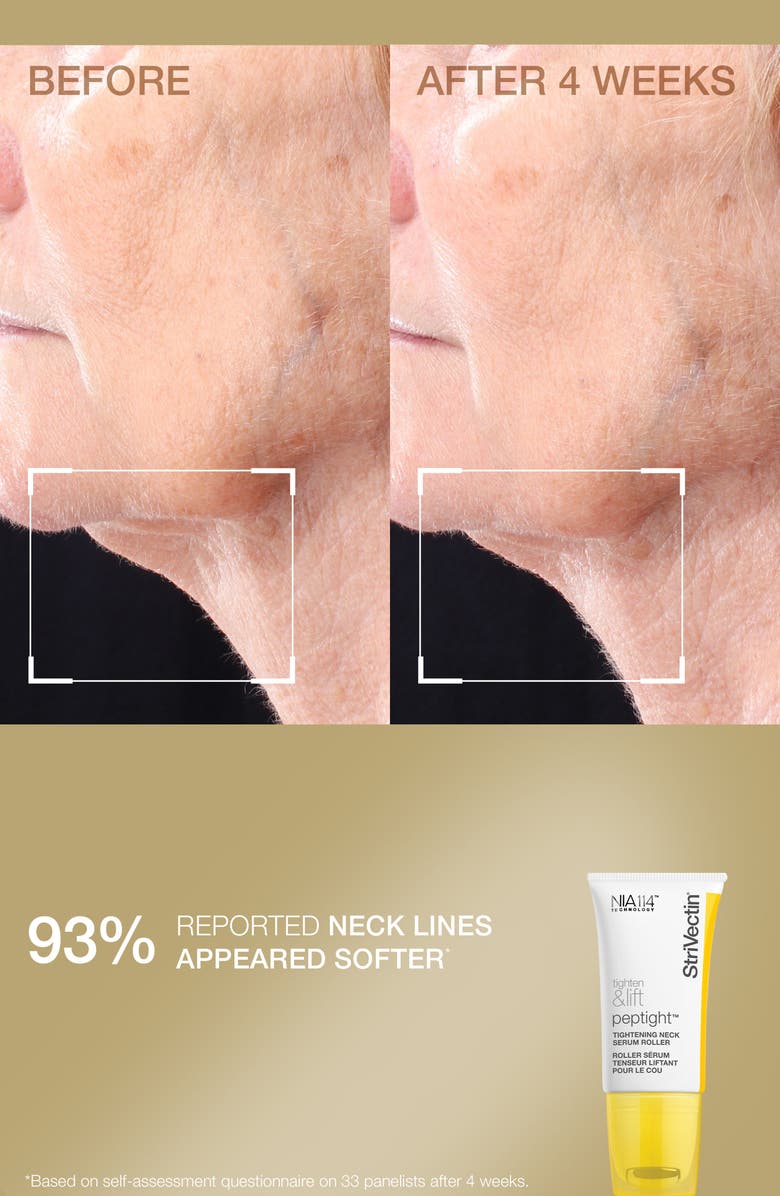 StriVectin<sup>®</sup> Tighten & Smooth Skin Care Set (Limited Edition) $146 Value, Alternate, color, 