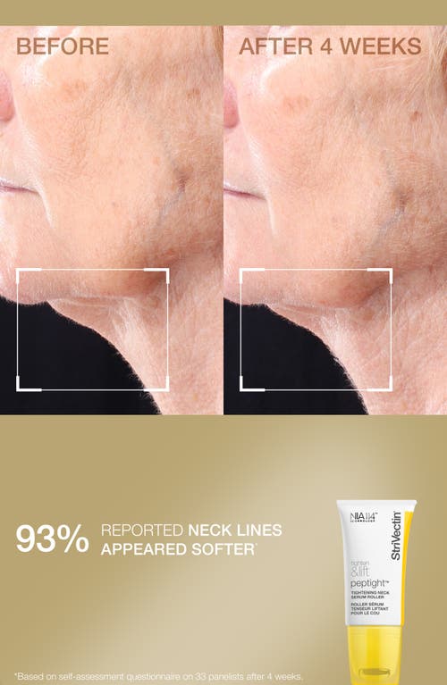 Strivectin ® Tighten & Smooth Skin Care Set In Transparent