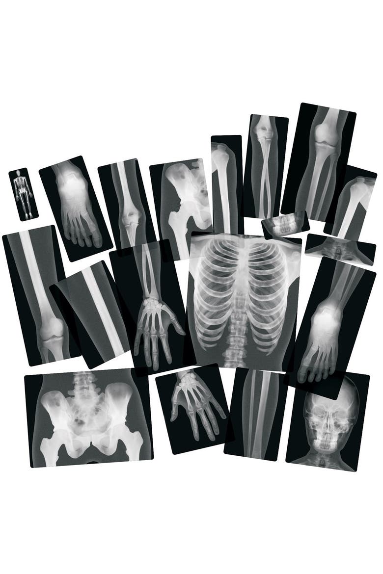 Human X-Rays on Film, Alternate, color, Multicolor