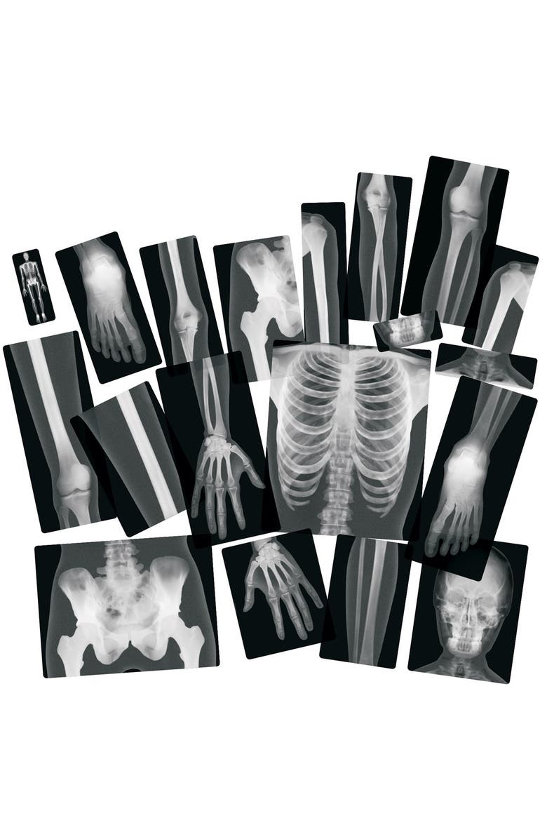 Roylco Human X-Rays on Film, Alternate, color, Multicolor