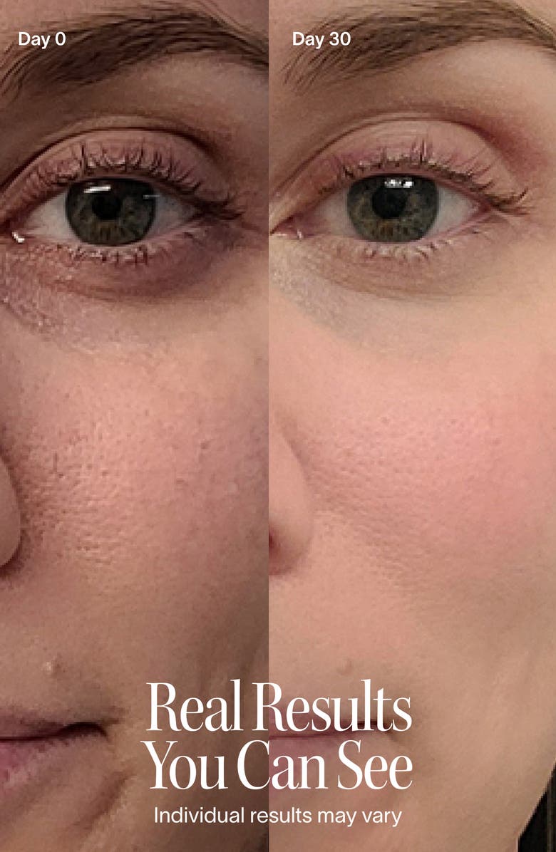 SolaWave 4-in-1 Red Light Skin Care Wand Set, Alternate, color,