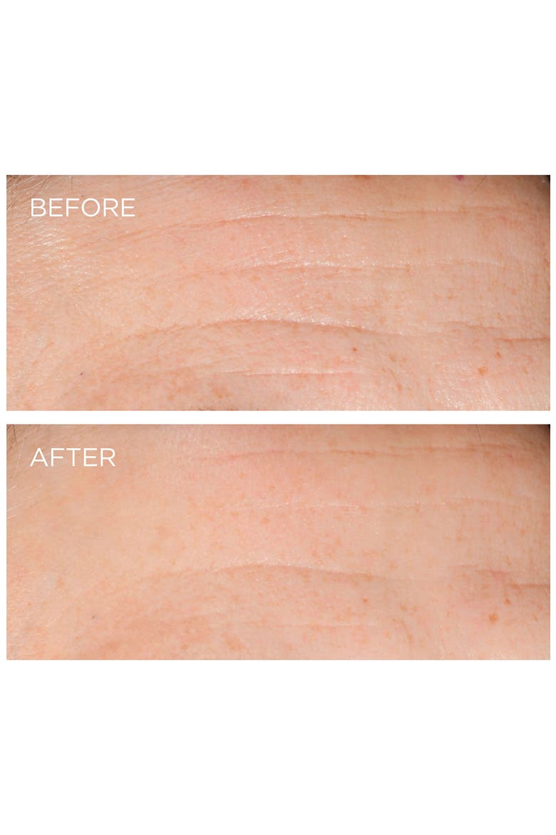 Dermarché® Labs 'FullFill' Hyaluronic Acid Topical Wrinkle Filler, Alternate, color, NO COLOR