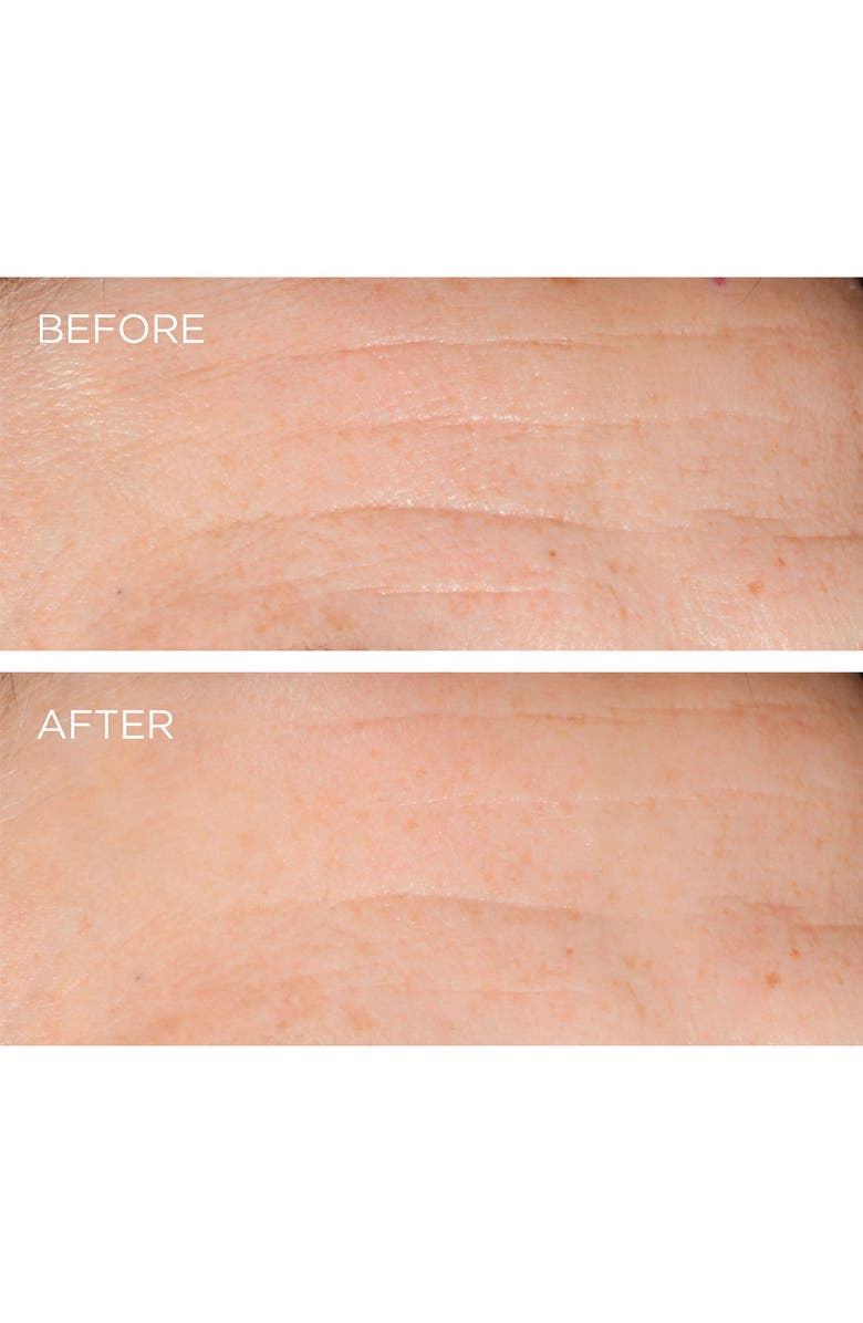 DERMARCHE LABS Dermarché<sup>®</sup> Labs 'FullFill' Hyaluronic Acid Topical Wrinkle Filler, Alternate, color, 