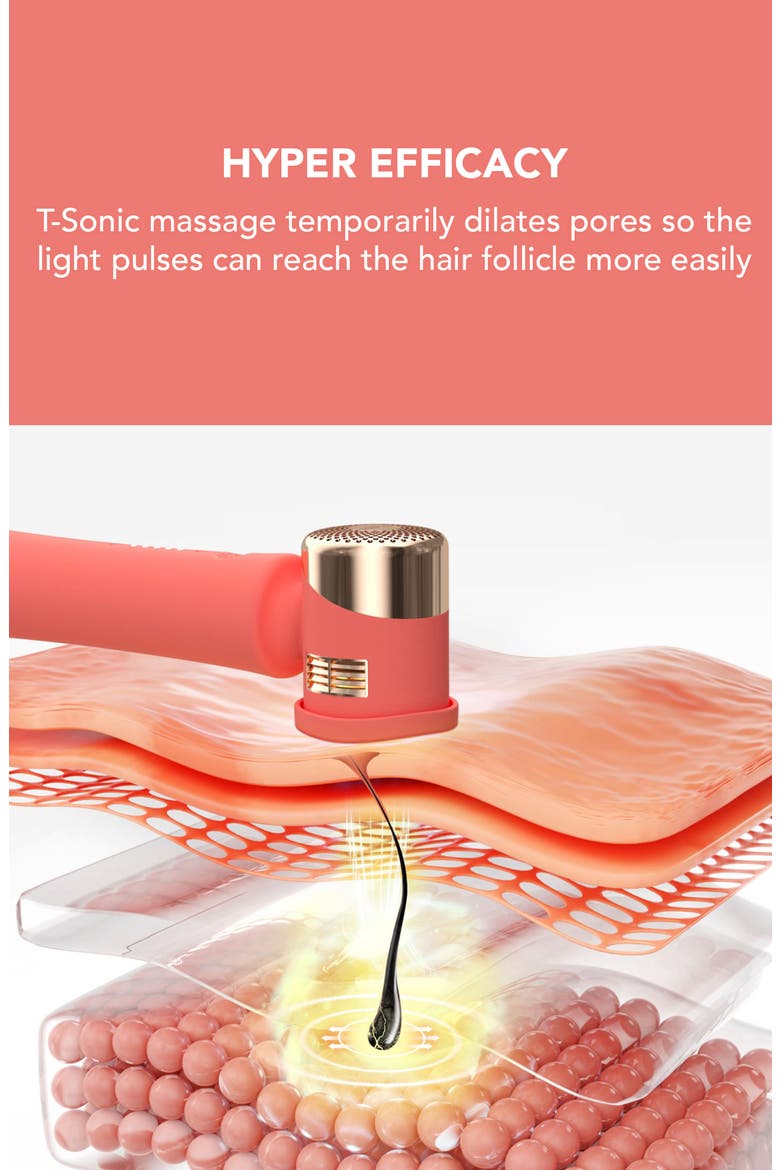PEACH™ 2 IPL Hair Removal Device, Alternate, color, PINK