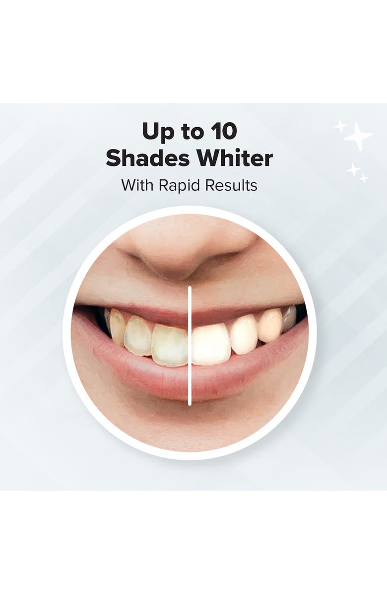 AQUASONIC Teeth Whitening Strips - Pack of 14, Alternate, color, 