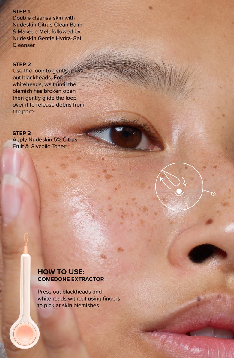 NUDESTIX Beauty Magnet 5-in-1 Professional Skin Care Tool, Alternate, color,