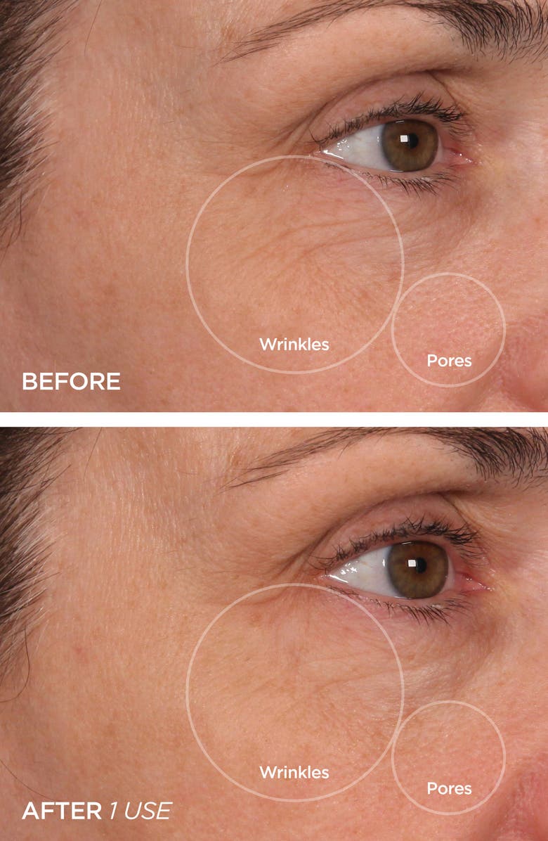 BeautyBio Cryo Dual Roller, Alternate, color,