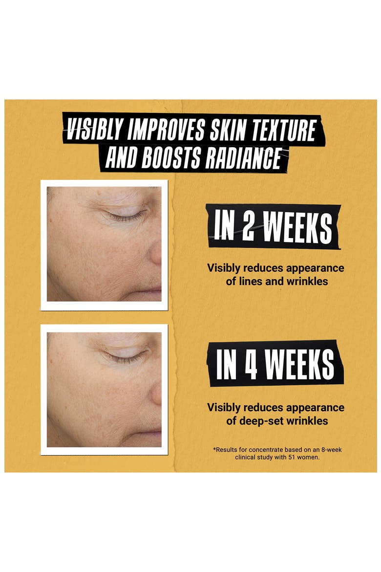 Powerful-Strength Line-Reducing Concentrate Serum $140 Value, Alternate, color, NO COLOR