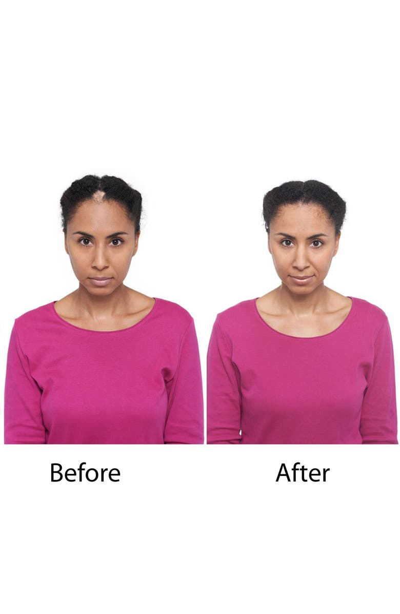 Keranique Deluxe Regrowth Treatment & Deep Hydration Set, Alternate, color,