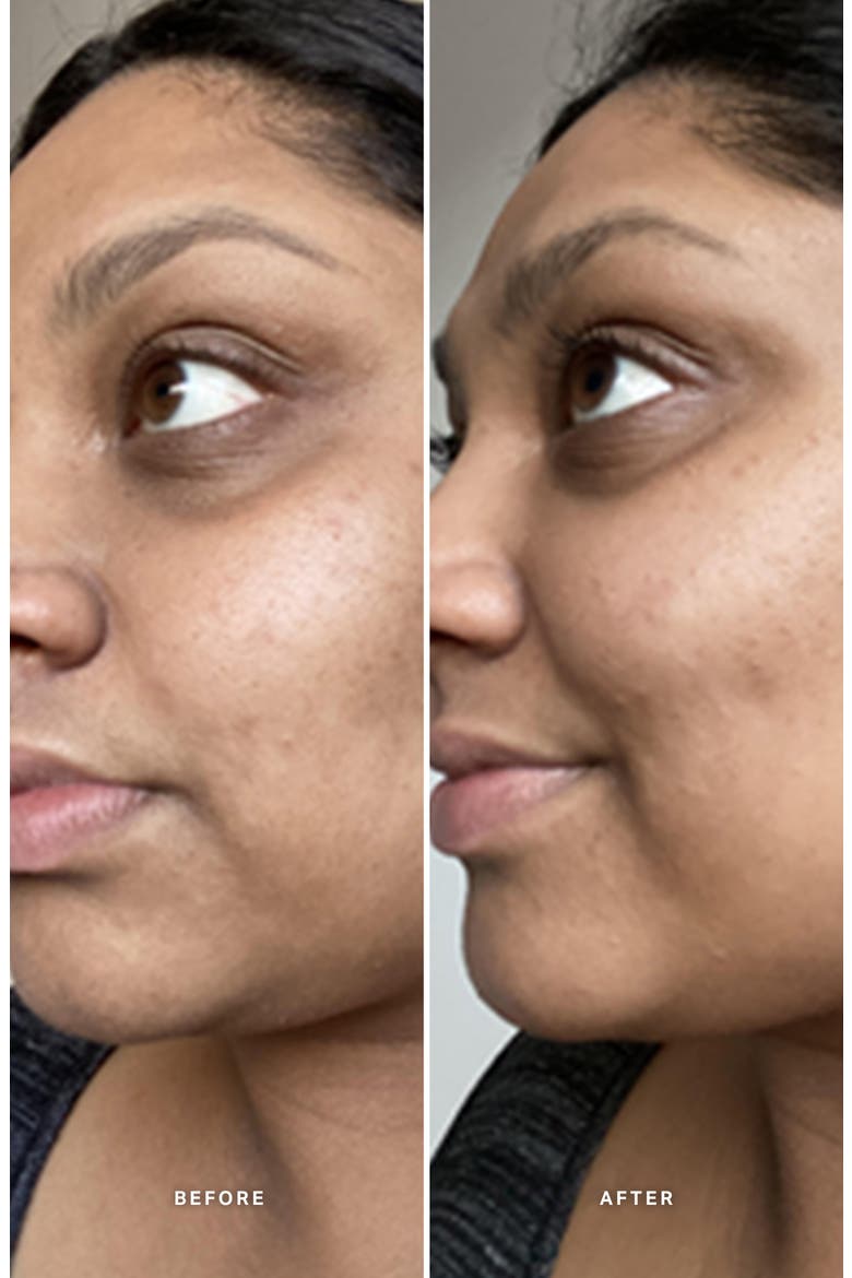 Liquid Gold™ Exfoliating Treatment with Glycolic Acid, Alternate, color, NO COLOR