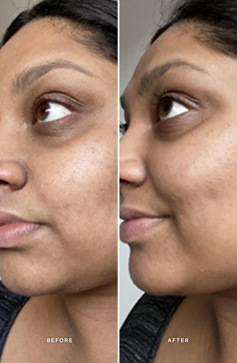 Alpha-H Liquid Gold<sup>™</sup> Exfoliating Treatment with Glycolic Acid, Alternate, color, 