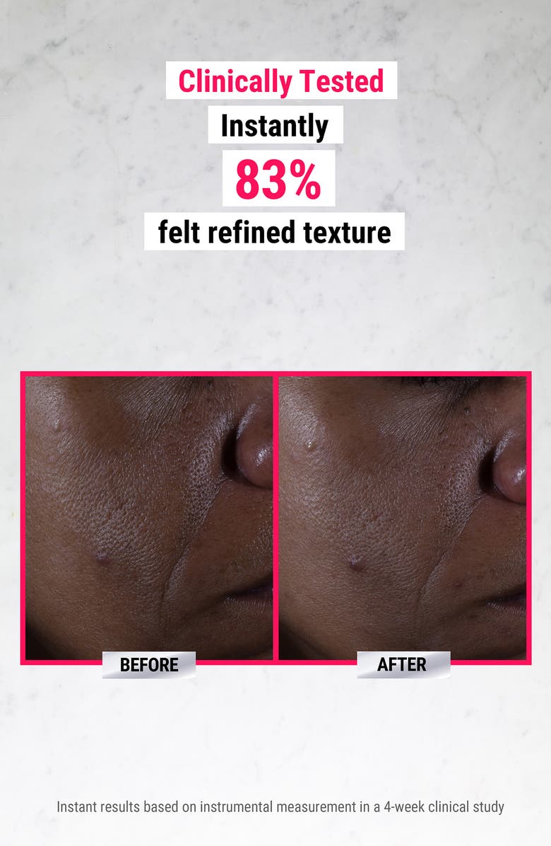 Kiehl's Since 1851 Ultra Pure High-Potency Serum 9.8% Glycolic Acid, Alternate, color, 