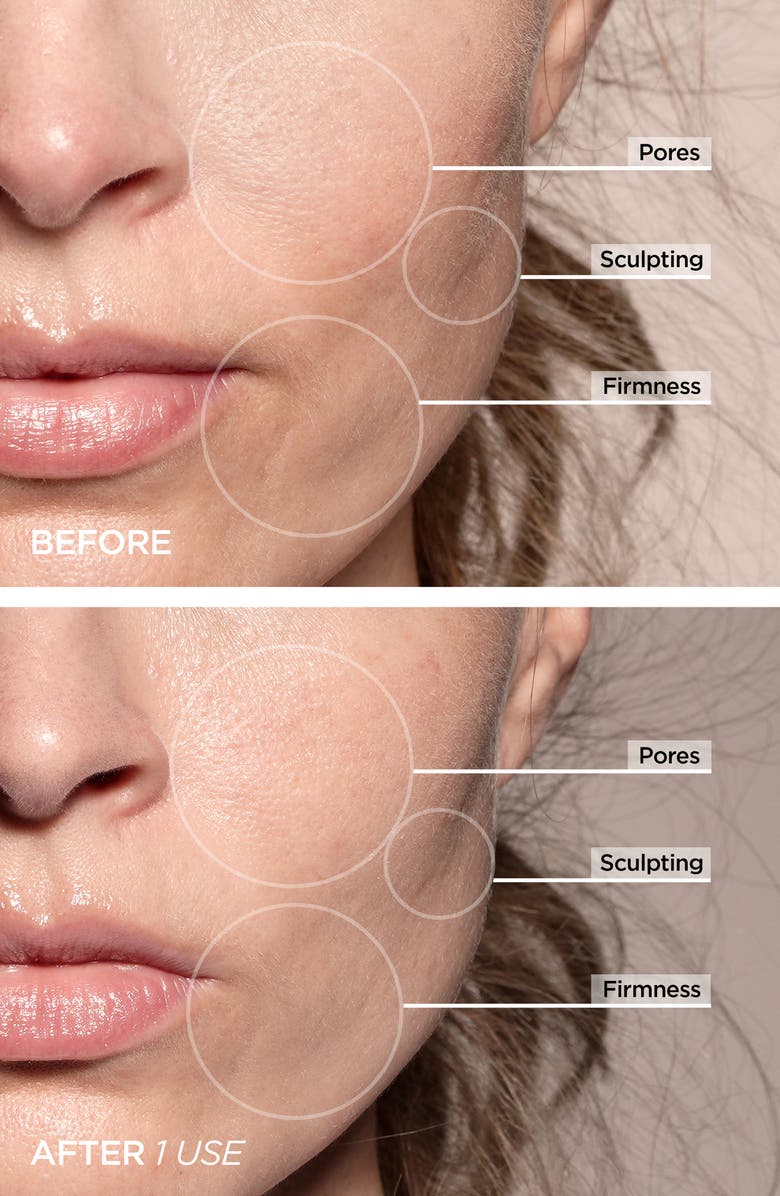 BeautyBio GloPRO<sup>®</sup> Cryo Roller Duo Attachments, Alternate, color,