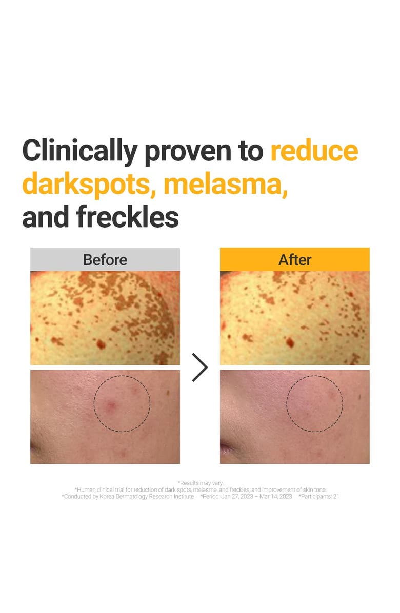 ROVECTIN Vita Dark Spot Serum, Alternate, color, Light Yellow