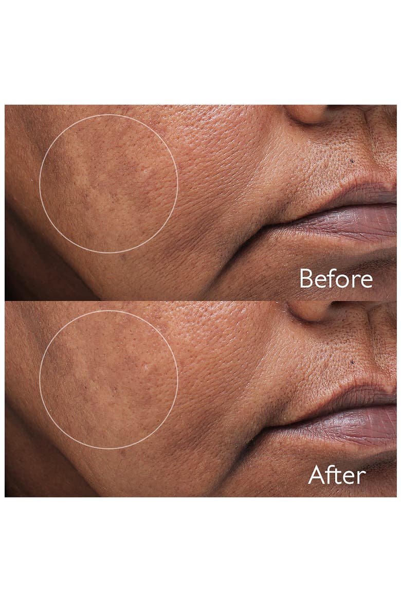 Vinoperfect Dark Spot Serum, Alternate, color, NO COLOR
