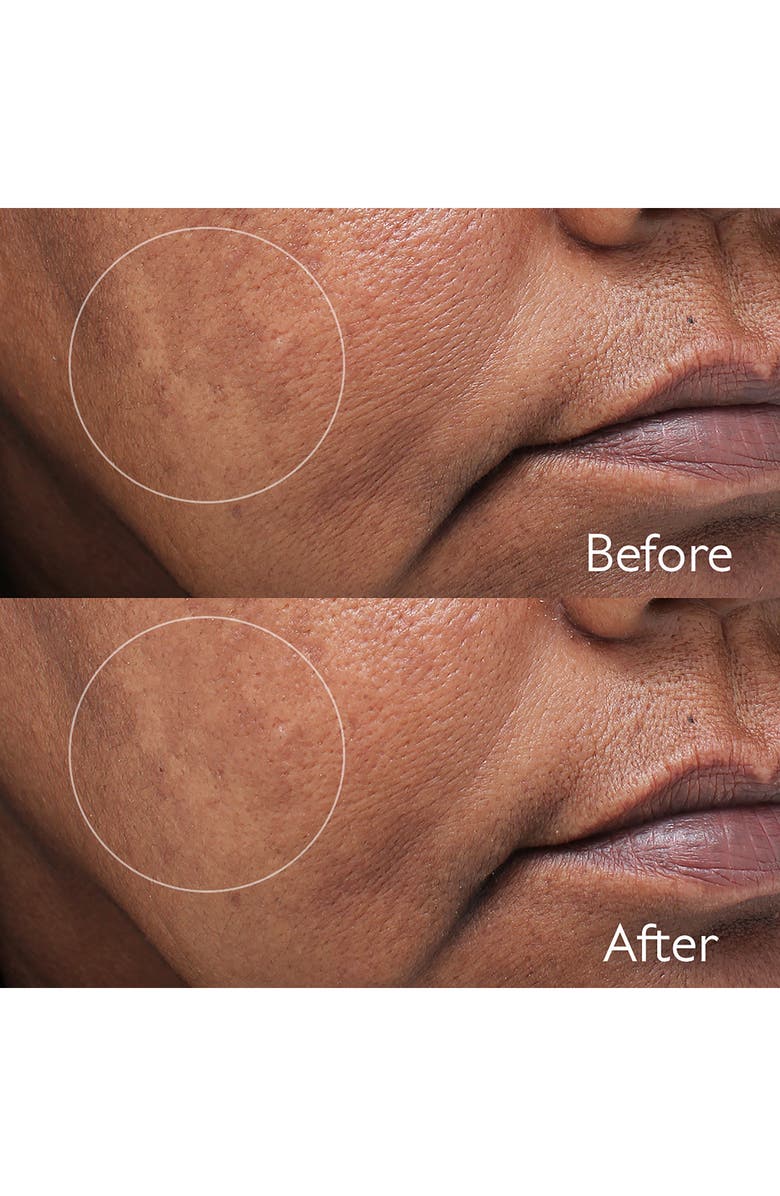 CAUDALÍE Vinoperfect Dark Spot Serum, Alternate, color,