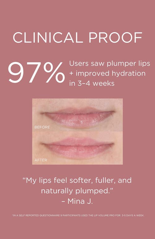 Solaris Laboratories Ny Led Lip Volume Pro Red Light Device For Plump Lips