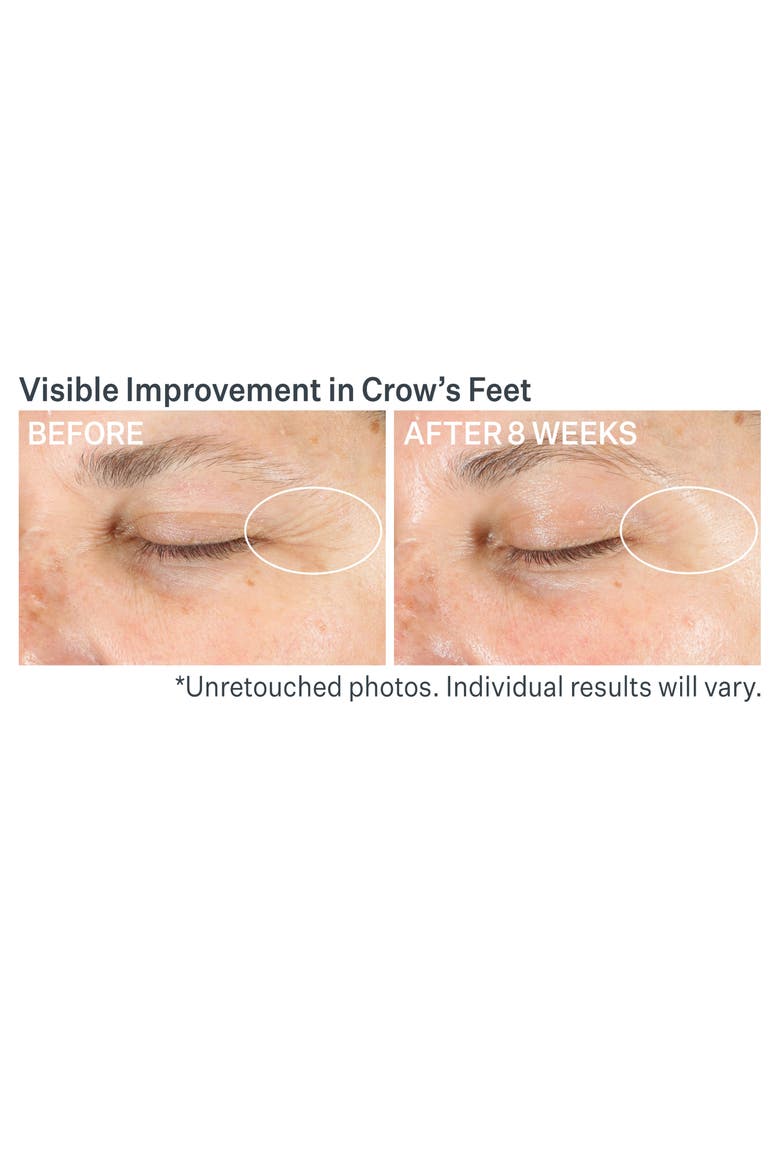 Advanced Retinol Multi-Correct Eye Cream, Alternate, color, NO COLOR
