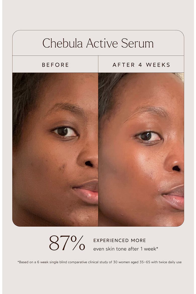 Chebula Active Anti-Aging Serum, Alternate, color, NO COLOR