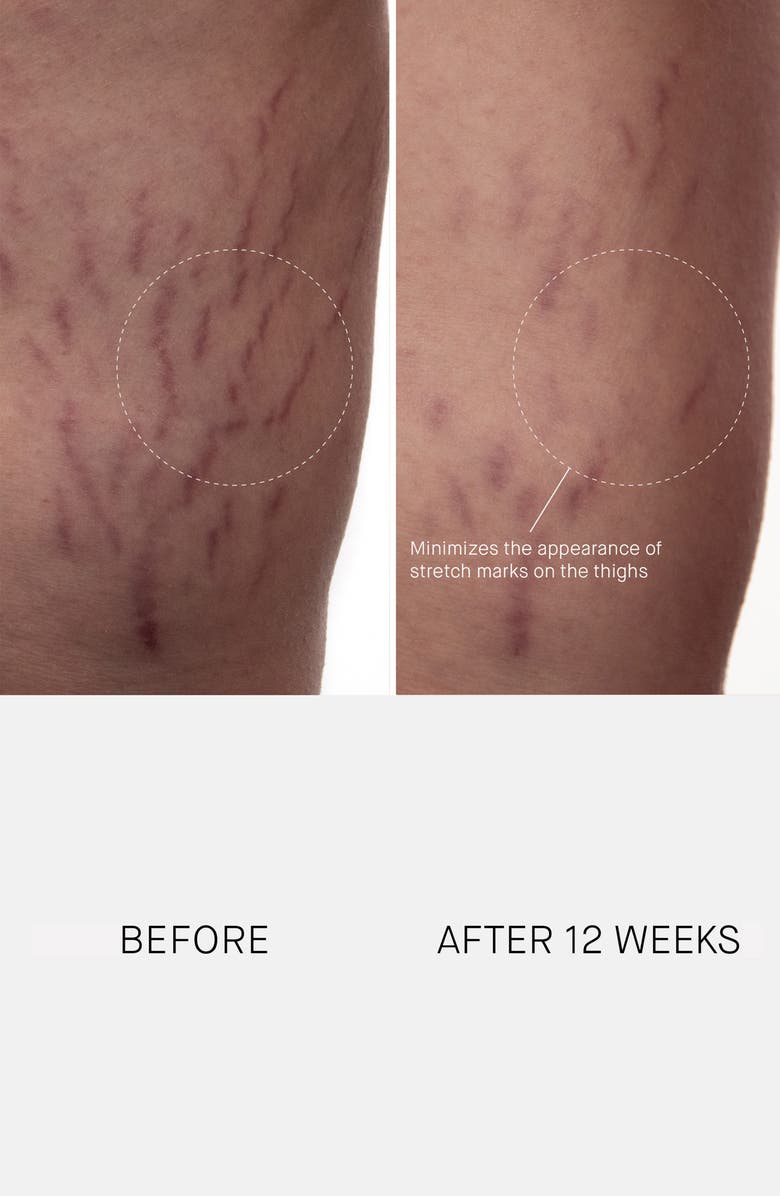 Augustinus Bader The Body Cream, Alternate, color,