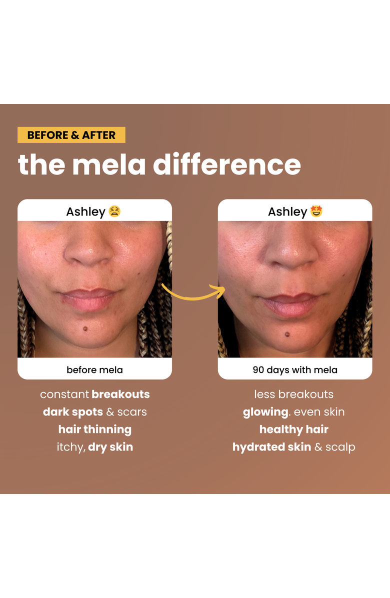 Mela Vitamins Daily Glow for Women of Color, Alternate, color, Coral