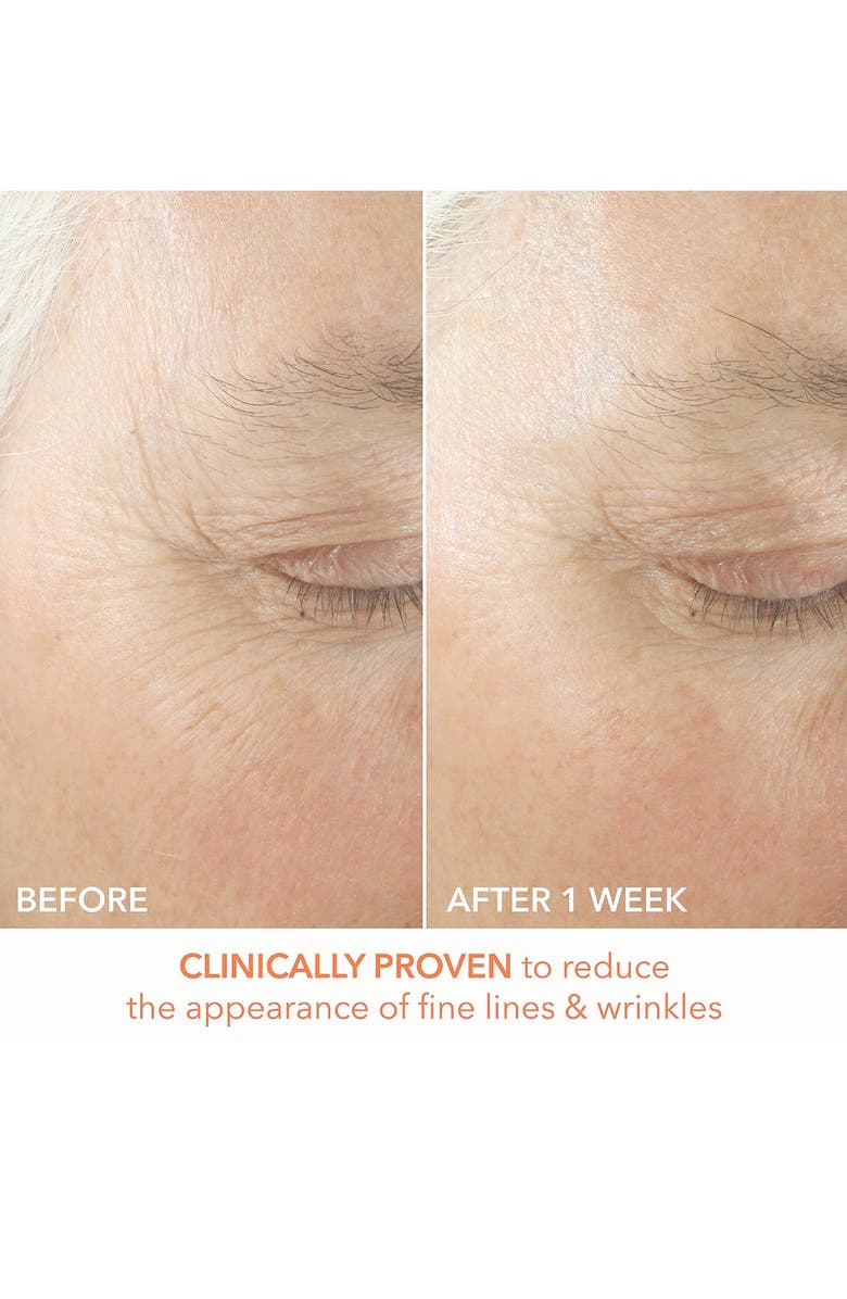 Dr. Dennis Gross Skincare Alpha Beta<sup>®</sup> Ultra Gentle Daily Peel - 30 Applications, Alternate, color, 