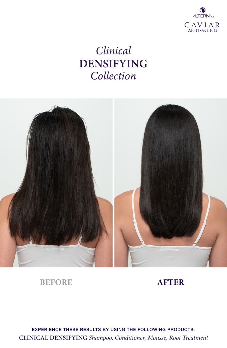 ALTERNA<sup>®</sup> Caviar Anti-Aging Clinical Densifying Leave-in Root Treatment, Alternate, color,