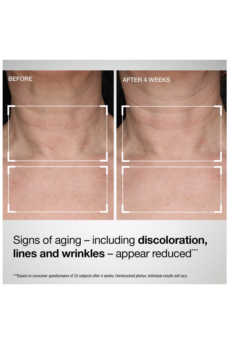 TL Advanced® Tightening Neck & Chest Lotion Broad Spectrum SPF 35 Sunscreen, Alternate, color, NO COLOR