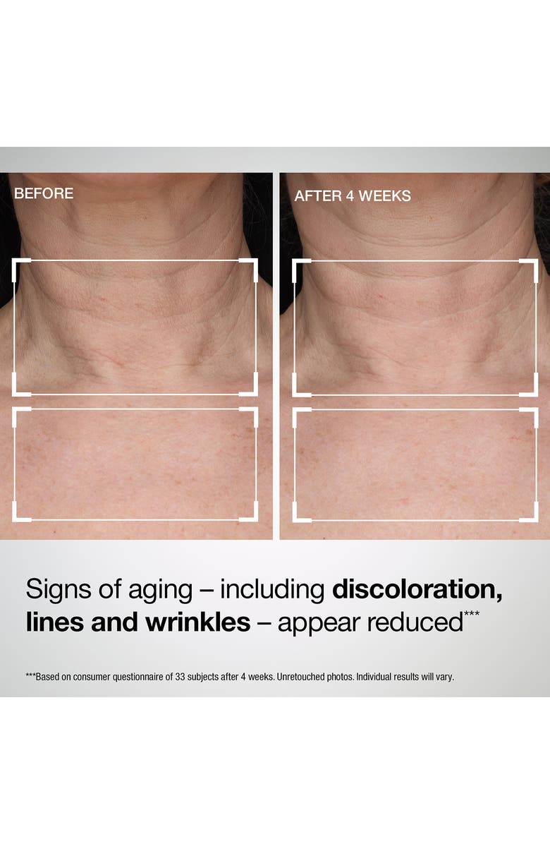 StriVectin<sup>®</sup> TL Advanced<sup>®</sup> Tightening Neck & Chest Lotion Broad Spectrum SPF 35 Sunscreen, Alternate, color, 