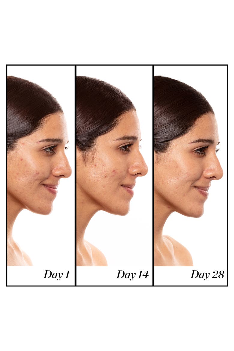A+ High-Dose Retinoid Serum, Alternate, color, NO COLOR