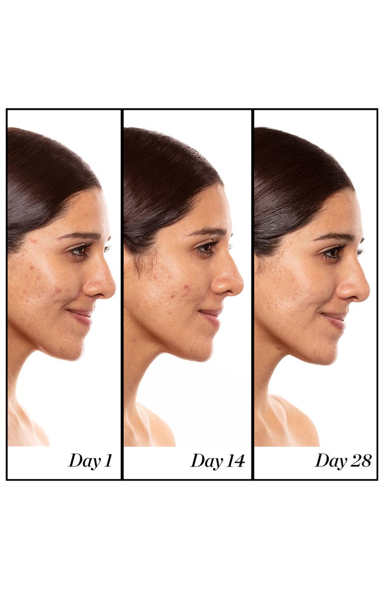 Sunday Riley A+ High-Dose Retinoid Serum, Alternate, color, 