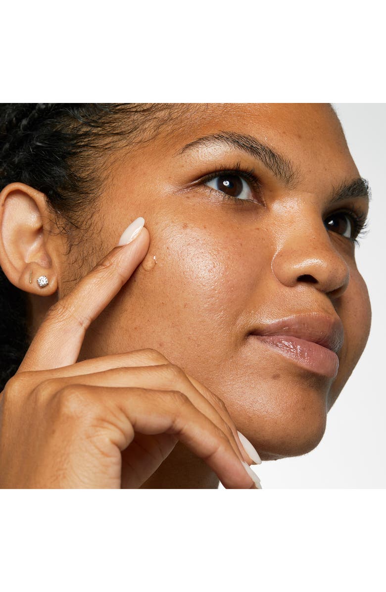 Clinique Acne Solutions Clinical Clearing Gel, Alternate, color, 