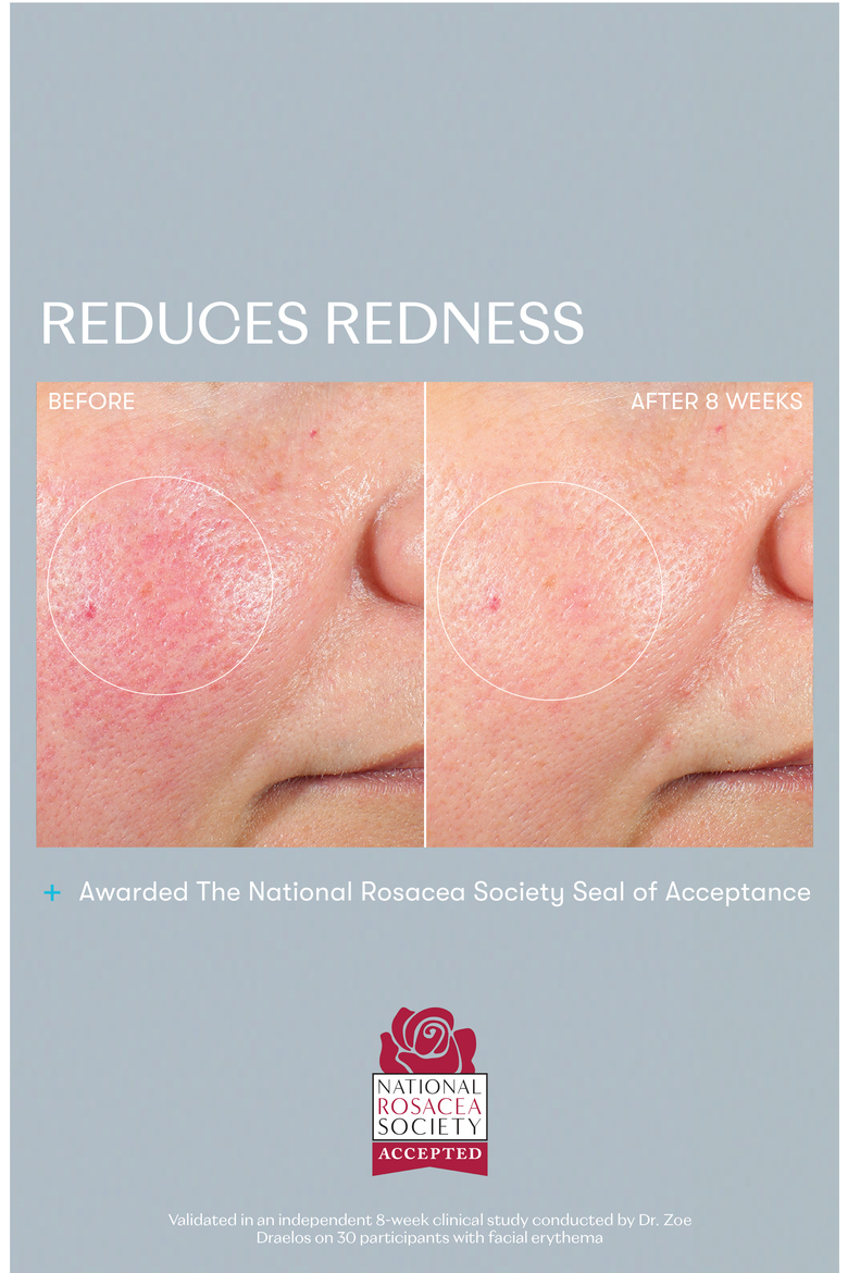 Skin Rescue Set $236 Value, Alternate, color, None