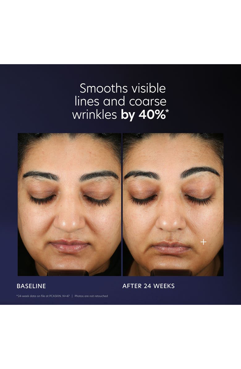 PCA Skin Pro-Max Age Renewal Serum, Alternate, color,
