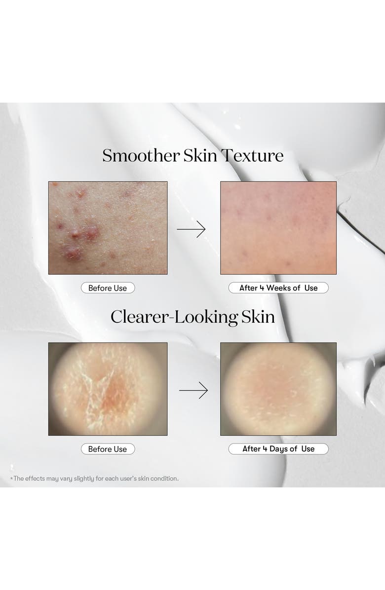 VT COSMETICS Reedle Shot<sup>™</sup> 700, Alternate, color, Silver