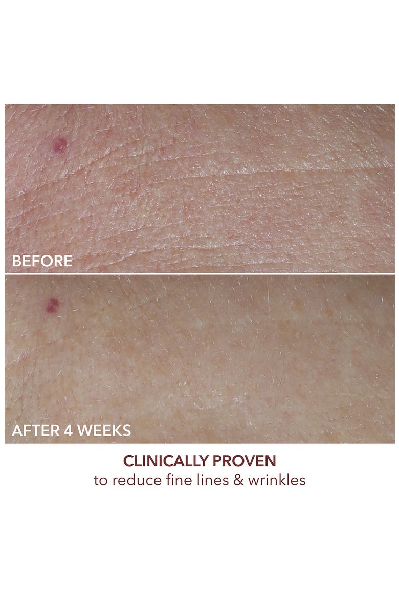 Advanced Retinol + Ferulic Overnight Texture Renewal Peel, Alternate, color, NO COLOR