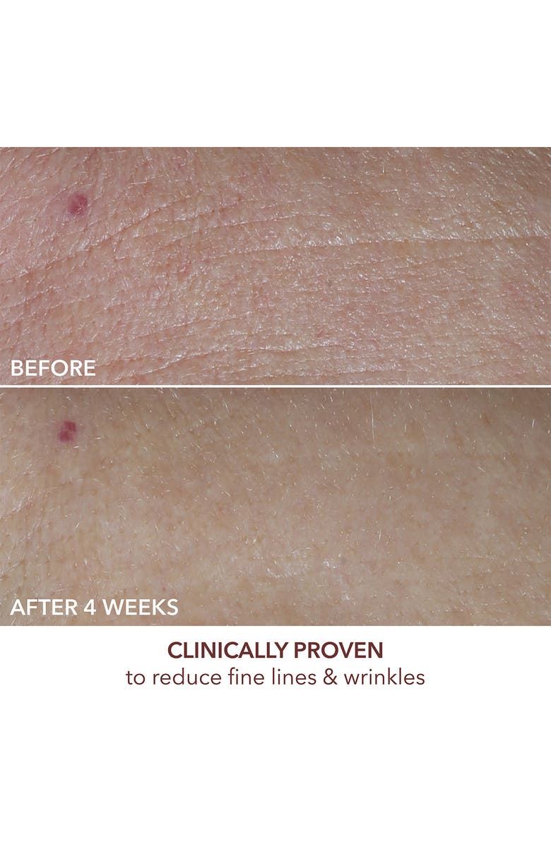 Dr. Dennis Gross Skincare Advanced Retinol + Ferulic Overnight Texture Renewal Peel, Alternate, color,