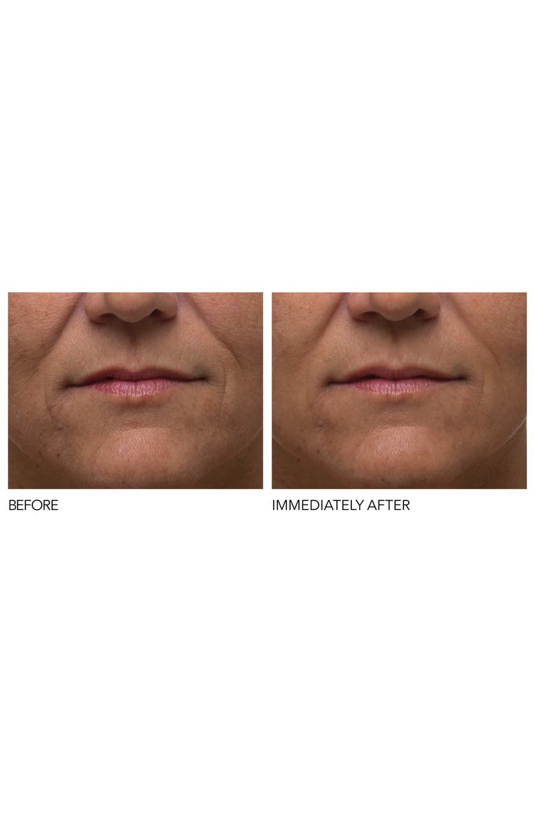 Dr. Dennis Gross Skincare Iconic Radiance Alpha Beta<sup>®</sup> Extra Strength Daily Peel, Alternate, color, 