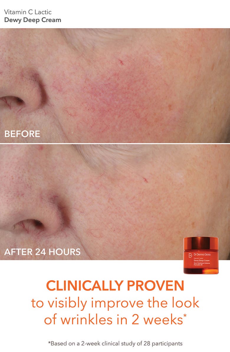 Dr. Dennis Gross Skincare Bright & Tight Delights Skin Care Set, Alternate, color,