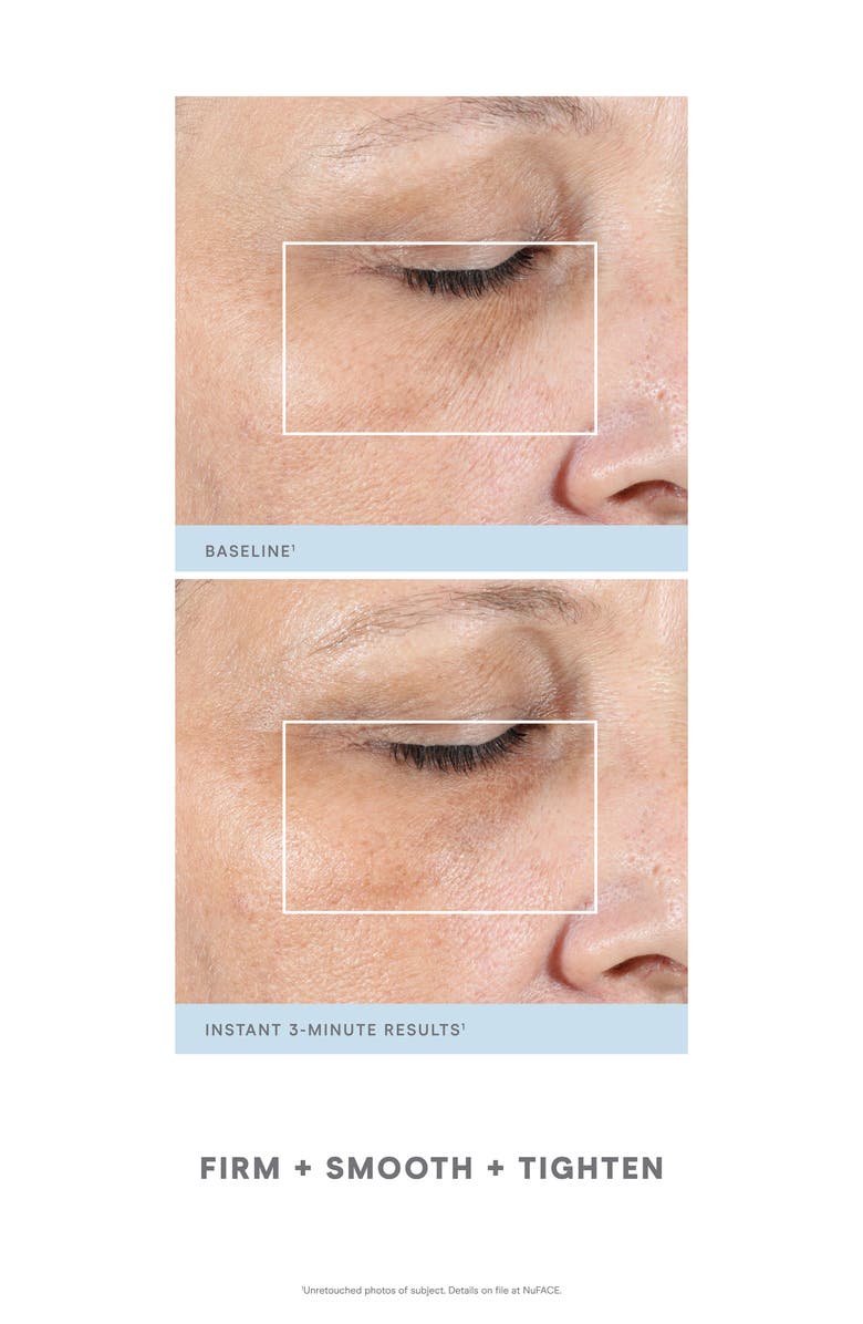 NuFACE<sup>®</sup> Petite Facial Kit-$358 Value, Alternate, color,