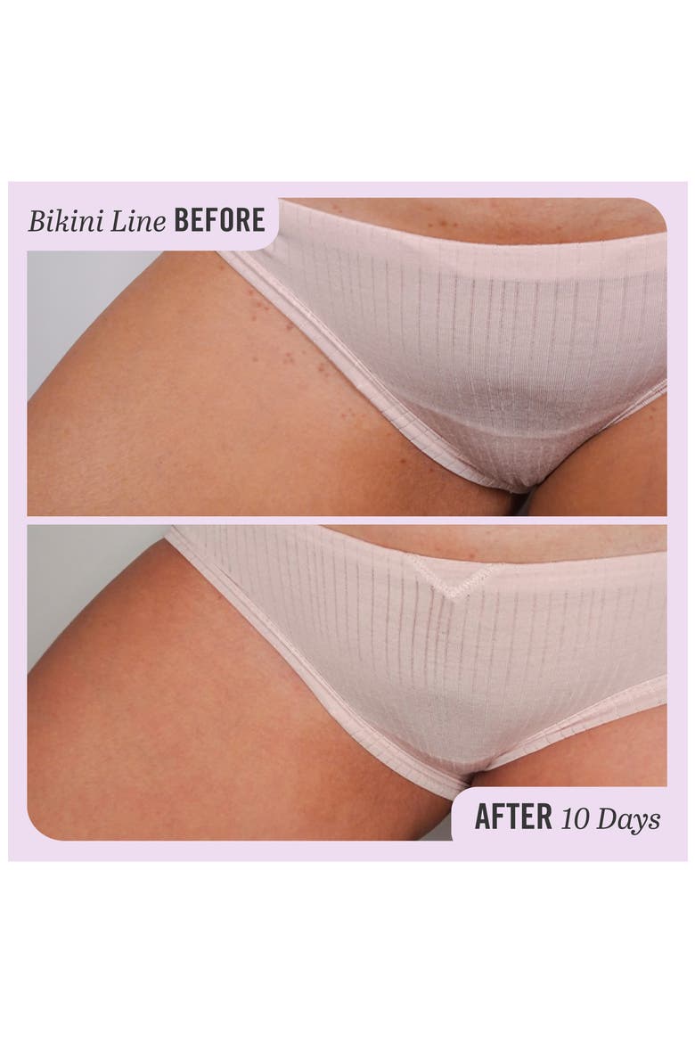 Ingrown Hair Pads with BHA & AHA, Alternate, color, NO COLOR