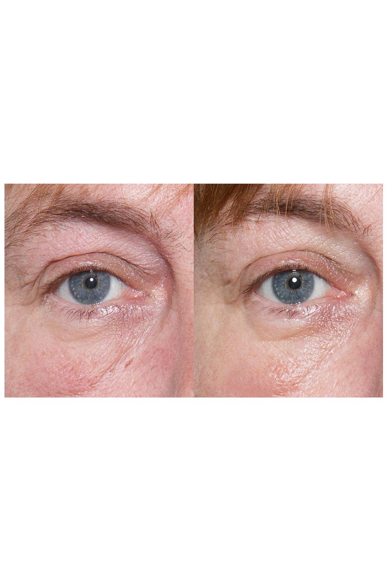 ReVit™ Microdermabrasion Device, Alternate, color, NO COLOR