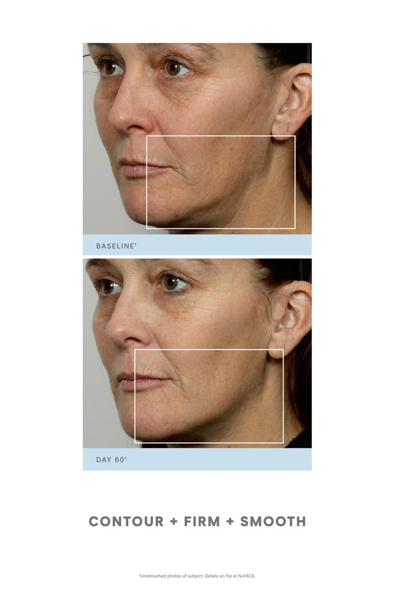 Trinity® Facial Toning Kit $339 Value, Alternate, color, NO COLOR