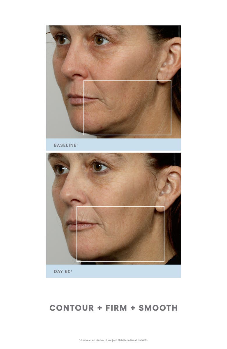 NuFACE<sup>®</sup> Trinity<sup>®</sup> Facial Toning Kit $339 Value, Alternate, color,