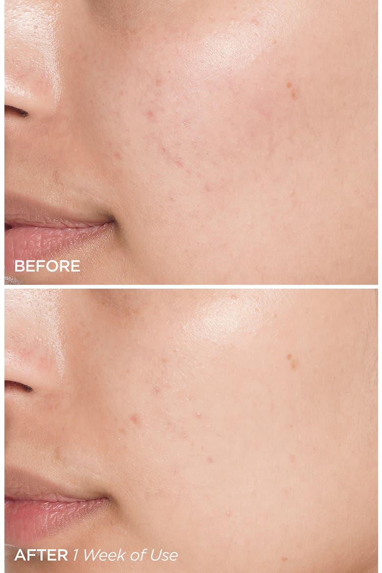 Swipe & Glow Peel Pads, Alternate, color, NO COLOR