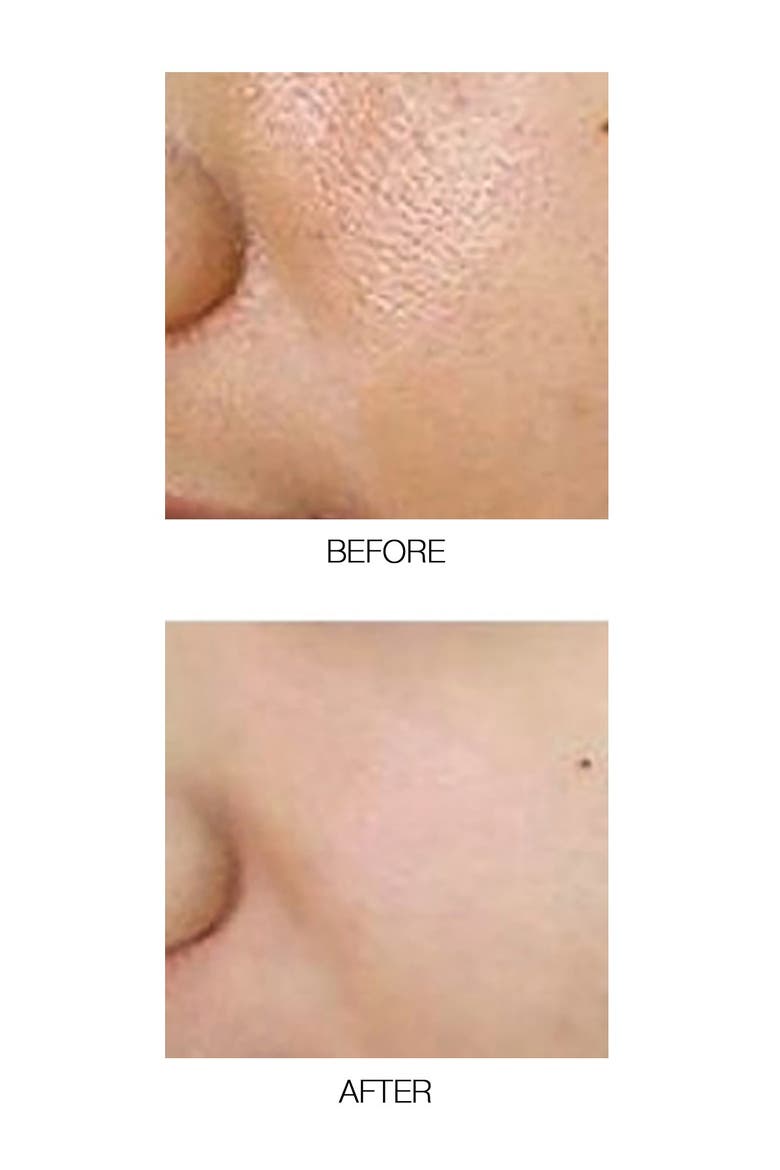 Fast Fix Blackhead Dissolve - Soft Compress Essence, Alternate, color, no color