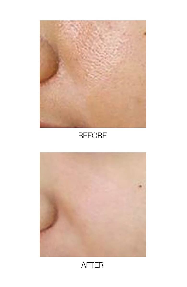 MIRENESSE Fast Fix Blackhead Dissolve - Soft Compress Essence, Alternate, color,